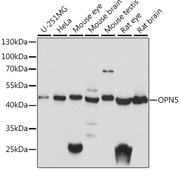 OPN5 Rabbit Polyclonal Antibody