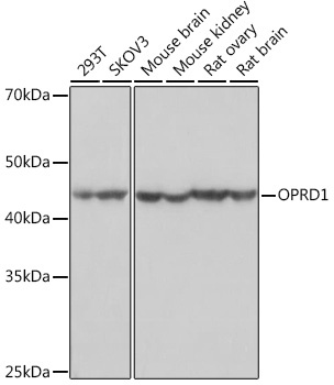 OPRD1 Rabbit Monoclonal Antibody