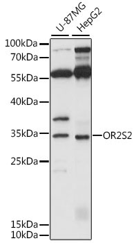 OR2S2 Rabbit Polyclonal Antibody