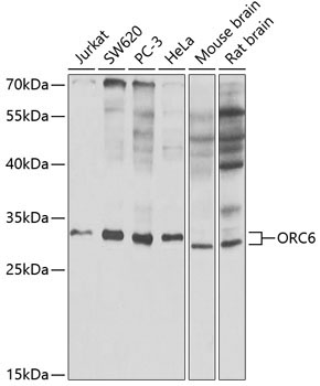 ORC6 Rabbit Polyclonal Antibody