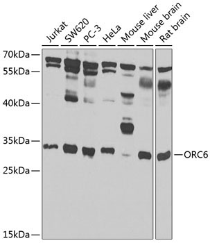 ORC6 Rabbit Polyclonal Antibody
