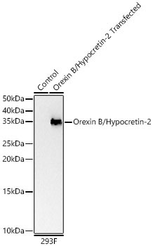 Orexin B/Hypocretin-2 Rabbit Polyclonal Antibody