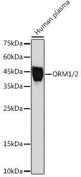ORM1/2 Rabbit Monoclonal Antibody