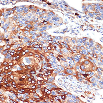 ORM1/2 Rabbit Monoclonal Antibody - Image 2