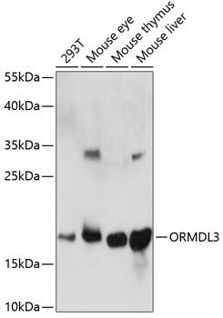 ORMDL3 Rabbit Polyclonal Antibody