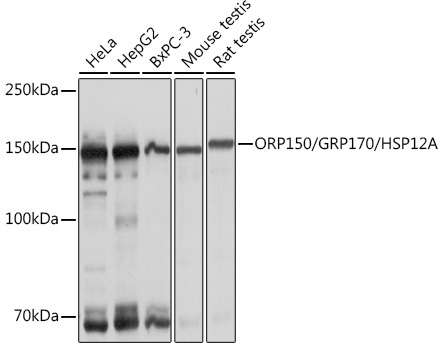 ORP150/GRP170/HSP12A Rabbit Monoclonal Antibody