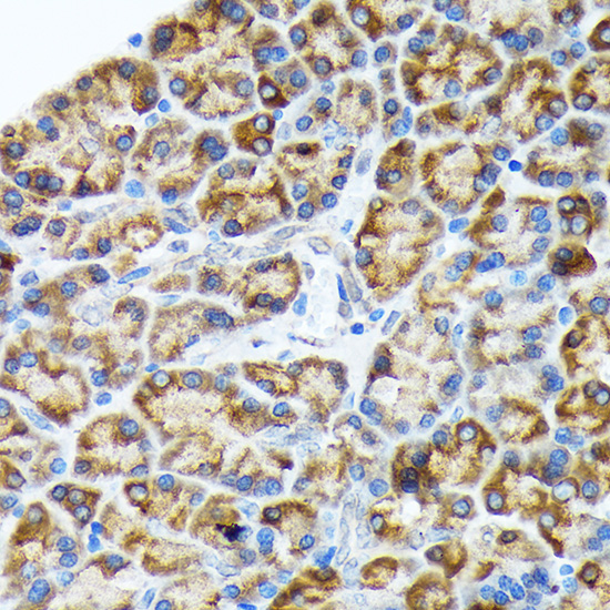 ORP150/GRP170/HSP12A Rabbit Monoclonal Antibody - Image 2