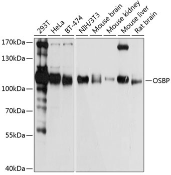 OSBP Rabbit Polyclonal Antibody