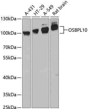 OSBPL10 Rabbit Polyclonal Antibody