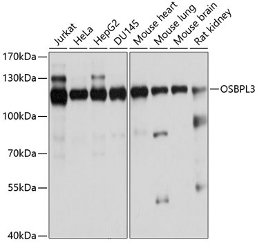OSBPL3 Rabbit Polyclonal Antibody