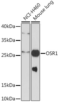 OSR1 Rabbit Polyclonal Antibody