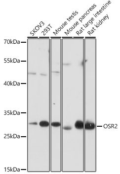 OSR2 Rabbit Polyclonal Antibody