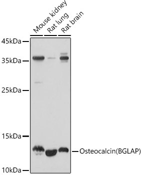 Osteocalcin (BGLAP) Rabbit Polyclonal Antibody