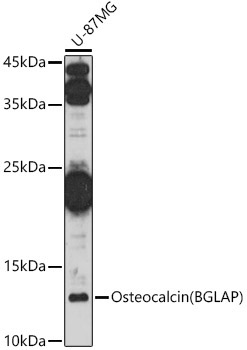 Osteocalcin (BGLAP) Rabbit Polyclonal Antibody - Image 2