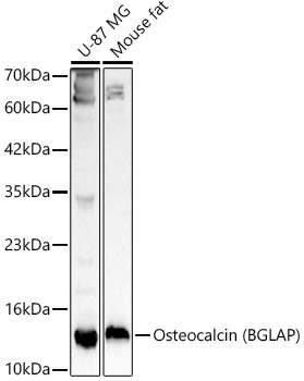Osteocalcin (BGLAP) Rabbit Polyclonal Antibody - Image 3
