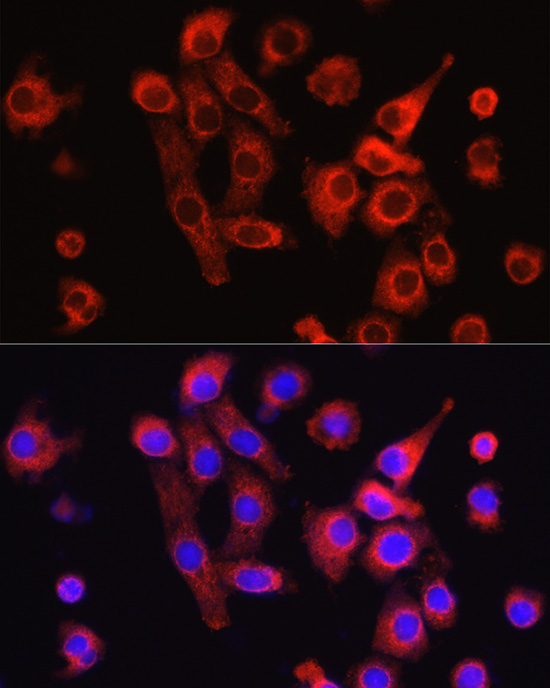 Osteocalcin (BGLAP) Rabbit Polyclonal Antibody - Image 4