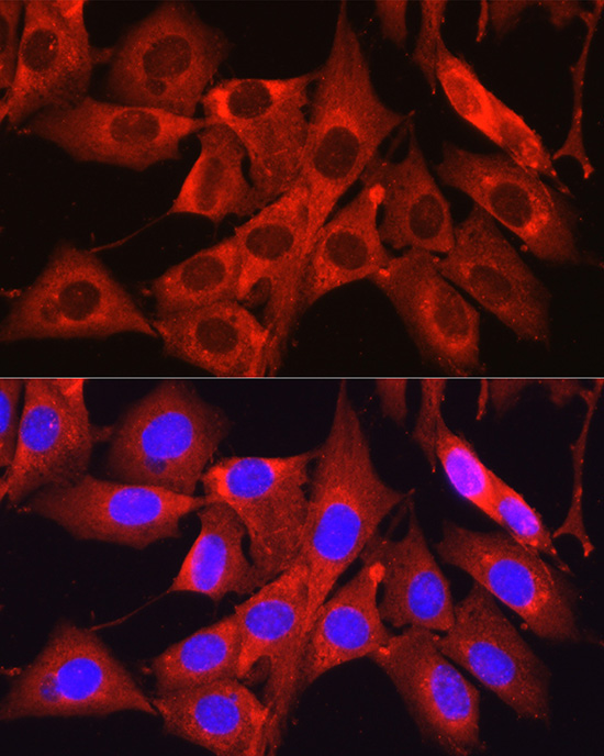 Osteocalcin (BGLAP) Rabbit Polyclonal Antibody - Image 5