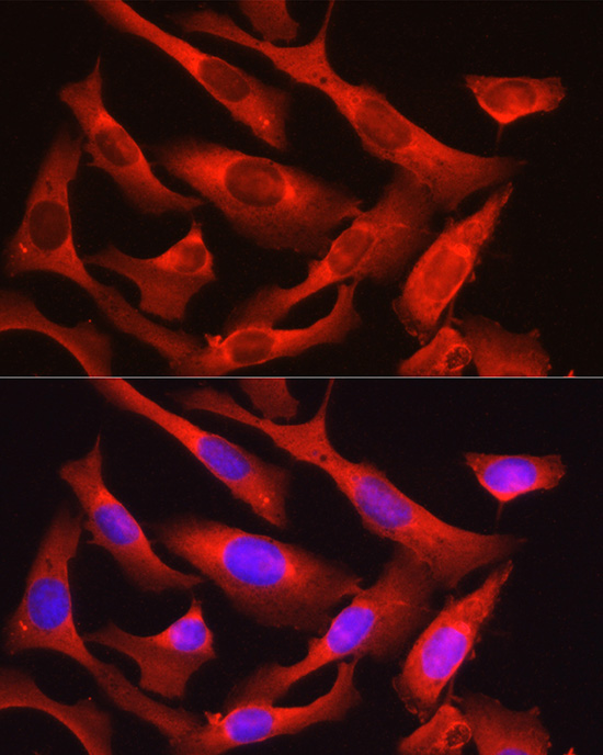 Osteocalcin (BGLAP) Rabbit Polyclonal Antibody - Image 6