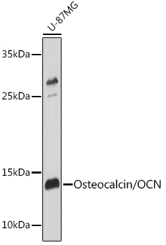 Osteocalcin (BGLAP) Rabbit Polyclonal Antibody