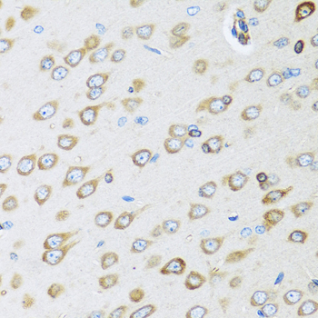 Osteoglycin (OGN) Rabbit Polyclonal Antibody - Image 2