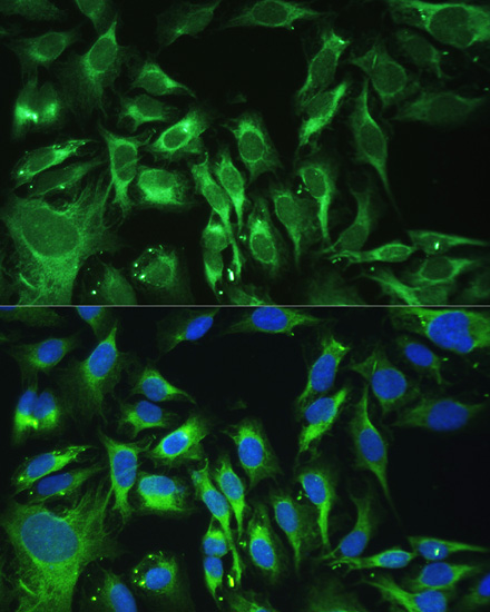 Osteoglycin (OGN) Rabbit Polyclonal Antibody - Image 4