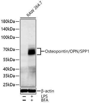 Osteopontin/OPN/SPP1 Rabbit Polyclonal Antibody