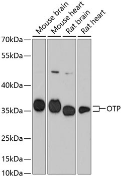 OTP Rabbit Polyclonal Antibody