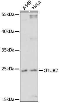 OTUB2 Rabbit Polyclonal Antibody