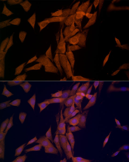 OTUD4 Rabbit Polyclonal Antibody - Image 2
