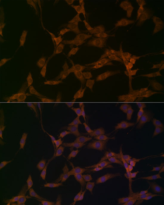 OTUD4 Rabbit Polyclonal Antibody - Image 3