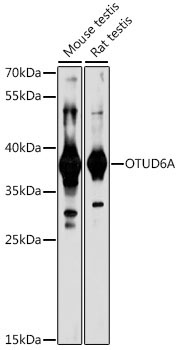 OTUD6A Rabbit Polyclonal Antibody