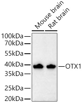 OTX1 Rabbit Monoclonal Antibody