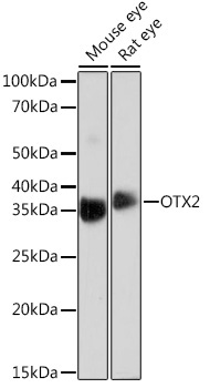 OTX2 Rabbit Monoclonal Antibody