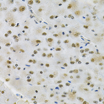 OTX2 Rabbit Polyclonal Antibody