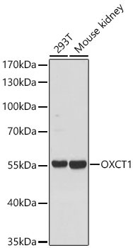 OXCT1 Rabbit Polyclonal Antibody