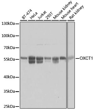 OXCT1 Rabbit Polyclonal Antibody