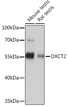 OXCT2 Rabbit Polyclonal Antibody