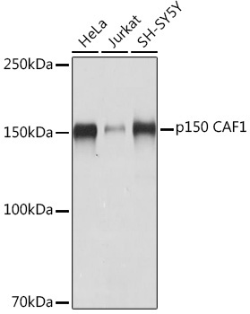 p150 CAF1 Rabbit Monoclonal Antibody