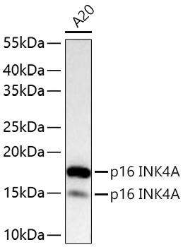 p16 INK4A Rabbit Polyclonal Antibody