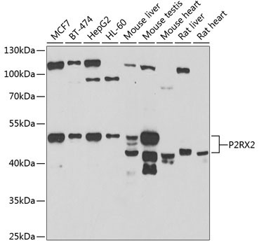 P2RX2 Rabbit Polyclonal Antibody
