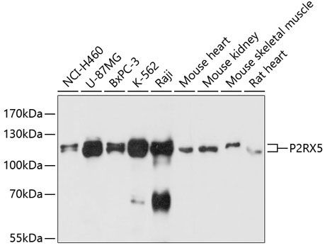 P2RX5 Rabbit Polyclonal Antibody