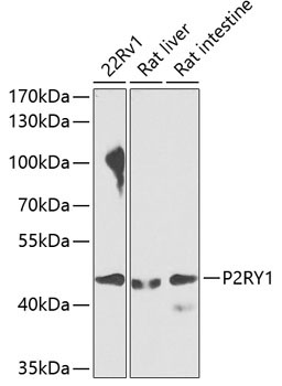 P2RY1 Rabbit Polyclonal Antibody