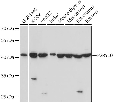 P2RY10 Rabbit Polyclonal Antibody