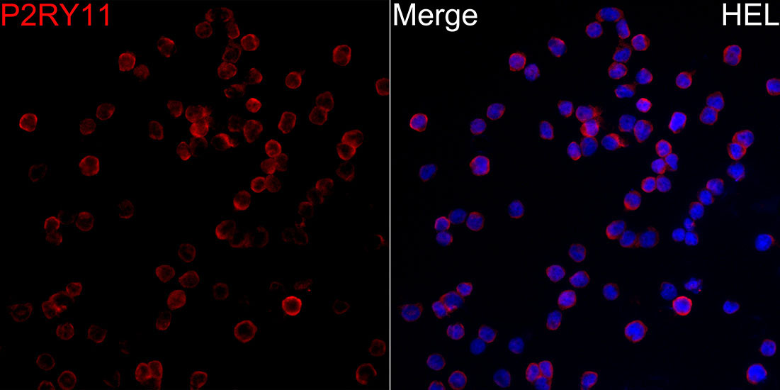 P2RY11 Rabbit Polyclonal Antibody