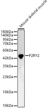 P2RY2 Rabbit Polyclonal Antibody