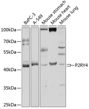 P2RY4 Rabbit Polyclonal Antibody