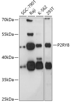 P2RY8 Rabbit Polyclonal Antibody