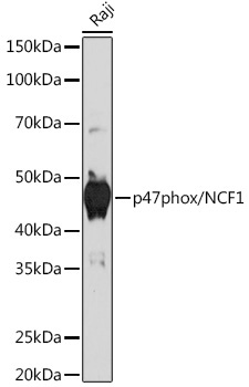 p47phox/NCF1 Rabbit Monoclonal Antibody