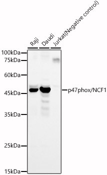 p47phox/NCF1 Rabbit Polyclonal Antibody