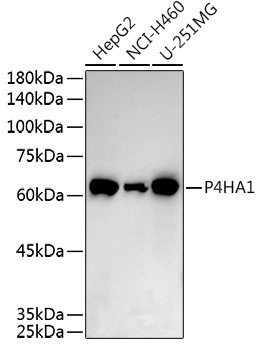P4HA1 Rabbit Polyclonal Antibody